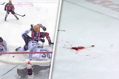 "Blutlache auf dem Eis" - Horrorszene in der DEL