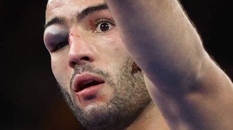 Parviz Nasibov kämpft im Ringen trotz übler Verletzungen um Gold