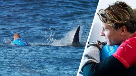 Julian Wilson nach der Hai-Attacke