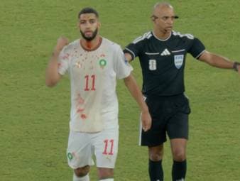 Bayern-Flirt Ismael Saibari blutet im WM-Spiel von Marokko gegen die Niederlande heftig am Kopf. Der Angreifer muss sein blutbeflecktes Trikot wechseln. 