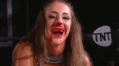 Britt Baker wurde bei AEW Dynamite heftig erwischt