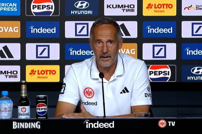 Eintracht-Coach will etwas loswerden