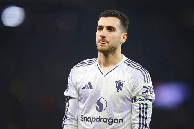 Heftige Kritik an United-Duo