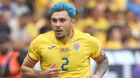 Andrei Ratiu fiel während der EM 2024 durch seine blaue Haarpracht auf