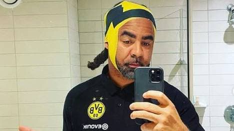 Patrick Owomoyela kam bei einem Sturz im Hotelzimmer mit einer Platzwunde am Kopf davon