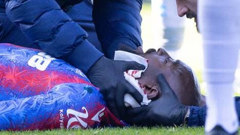 Jean-Philippe Mateta musste eine Operation über sich ergehen lassen