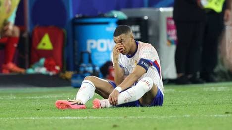 Kylian Mbappé kassierte kurz nach seiner Nasenverletzung eine Gelbe Karte