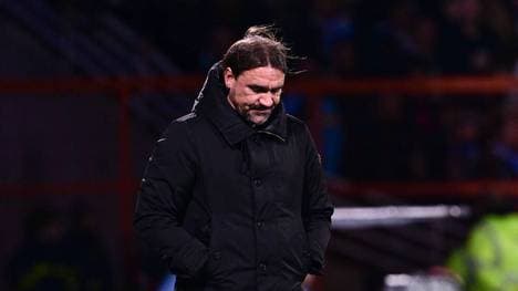 Gladbach-Trainer Daniel Farke muss auf einige Spieler verzichten