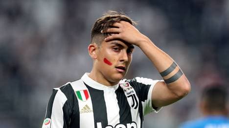 Auch Paulo Dybala unsterstütze die Lippenstift-Aktion