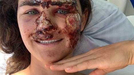 Alice Merryweather nach ihrem schweren Trainingsunfall