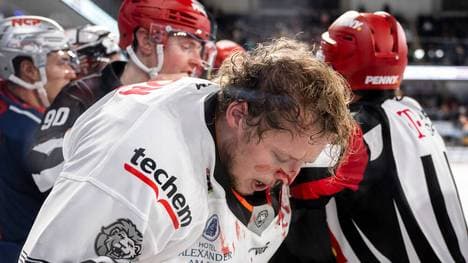 Ryan Olsen fiel immer wieder negativ auf