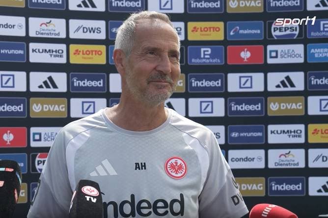 Hütter zurück - doch ein Name sorgt für Rätselraten