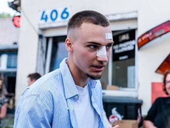 Tim Lemperle spielt mit der TSG Hoffenheim eine herausragende Bundesliga-Saison. Der Angreifer spricht im SPORT1-Interview auch über seinen aneckenden Charakter und die Party-Schlägerei im letzten Mai, die ihn einen Einsatz im Aufstiegsspiel mit dem 1. FC Köln kostete.