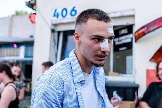 Reue nach folgenschwerer Schlägerei