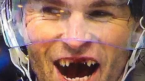 Jaromir Jagr wünscht sich zu Weihnachten ein paar neue Zähne