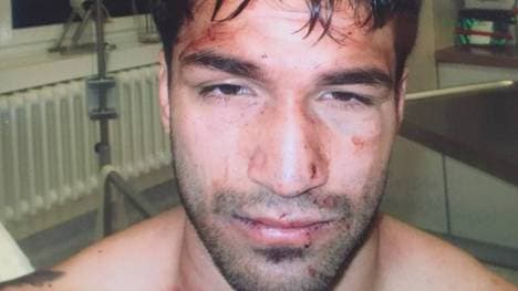 Abdulwahab Alshawa wurde in seine Wohnung ausgeraubt und zusammengeschlagen