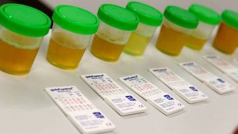 Der Kampf gegen Doping wurde seit Beginn der Corona-Krise heruntergefahren