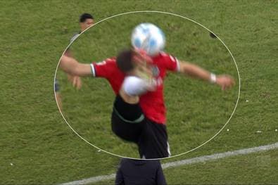 Die kurioseste Verletzung dieser Saison?