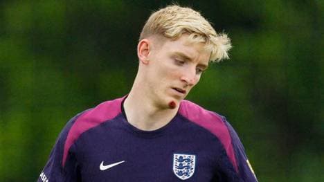 Anthony Gordon verletzte sich am Gesicht