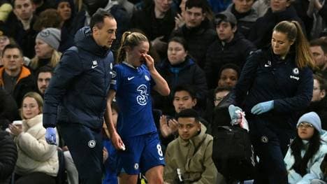 Melanie Leupolz nimmt Gesichtsverletzung mit Humor