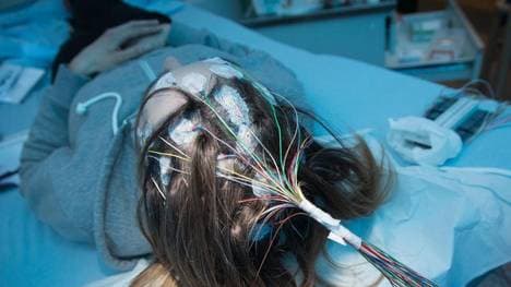 Ein epileptischer Anfall kann beispielsweise auch durch Blutzuckerschwankungen oder extremen Schlafmangel ausgelöst werden