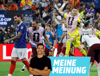 Sie haben genau das, was Nagelsmann gern gehabt hätte