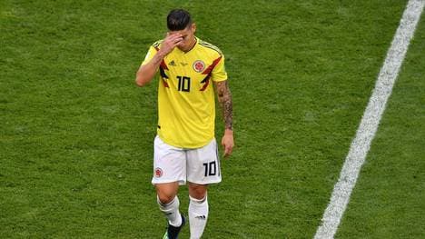 James musste im letzten Gruppenspiel gegen den Senegal verletzt ausgewechselt werden