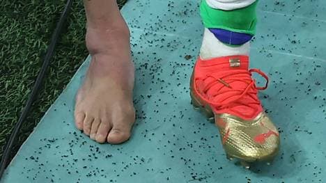 Brasiliens Star Neymar erlitt eine Knöchelverletzung