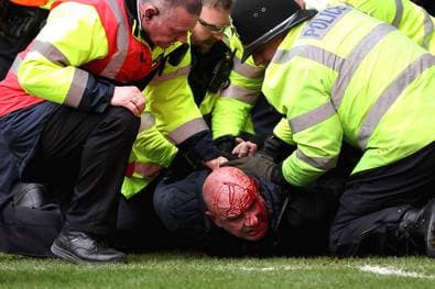 Blutige Krawalle bei England-Derby