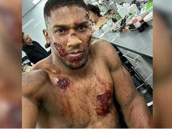 Bei Dreharbeiten für den Trailer des Mega-Boxevents in Riad am 23. Dezember postete Anthony Joshua ein Bild, dass ihn blutüberströmt zeigt.