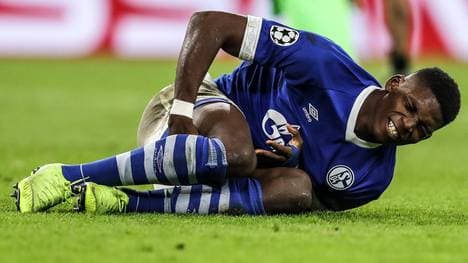 Schalke 04: Breel Embolo bricht sich den linken Fuß, Der Schalker Breel Embolo fällt nach einem Fußbruch aus