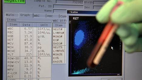 NADA untersucht die digitale Matrix