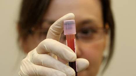 Olympic Preview - Day -3