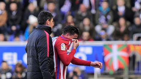 FBL-ESP-LIGA-ALAVES-ATLETICO