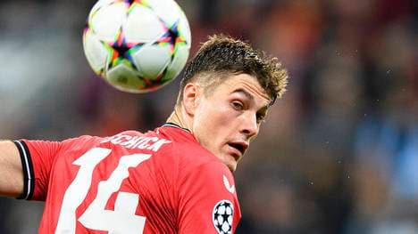 Patrik Schick schlägt sich mit einer mysteriösen Verletzung herum