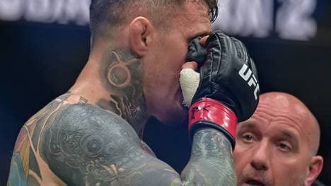 Tom Aspinall konnte bei UFC 321 wegen einer Augenverletzung nicht mehr weitermachen