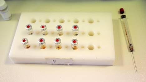 Die russische Leichtathletik wird von einem Dopingskandal erschüttert