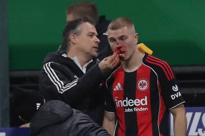 Blutiger Zwischenfall hat Folgen