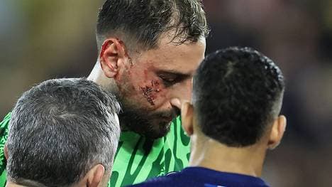 Donnarumma bekam einen Stollen ins Gesicht