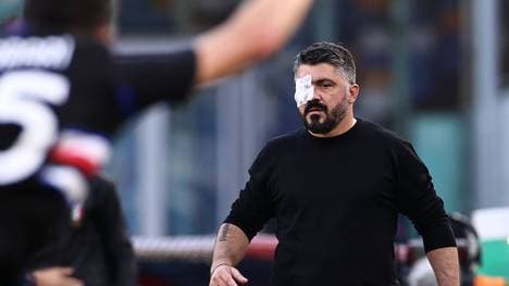 Gattusos rechtes Auge ist betroffen