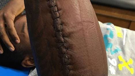 Thomas Davis ließ sich auch von einem gebrochenen Arm nicht stoppen