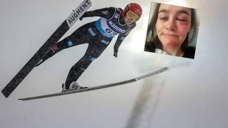 Selina Freitag verletzte sich bei einem Sturz im Gesicht