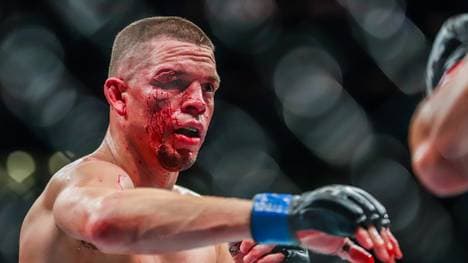 Wie bereits bei einem Kampf 2019 sah Nate Diaz erneut schwer gezeichnet aus