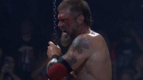 Adam Copeland hat sich das Schienbein gebrochen