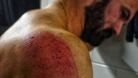 Drew McIntyre steckte bei WWE SmackDown heftig ein