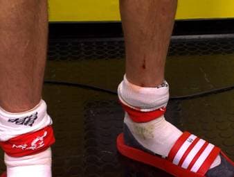 Nico Schlotterbeck entgeht beim 2:3 gegen den FC Bayern einem Platzverweis nur knapp. Das sieht auch Bayern-Profi Josip Stanisic so. 