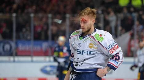 Manuel Wiederer (Bild) muss nach einer Schlägerei mit Patrick Hager blutend vom Eis