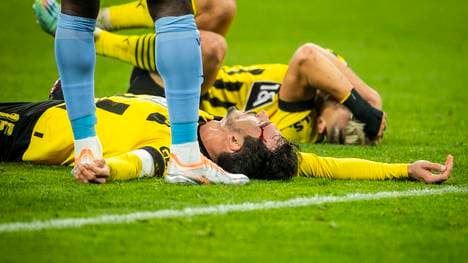 GER, 1.FBL, VfL Bochum vs 1. FC Köln 05.11.2022, Signal Iduna Park, GER, 1.FBL, Borussia Dortmund vs VfL Bochum im Bild Nach Zusammenprall bleiben Nico Schlotterbeck (Borussia Dortmund 04) und Mats Hummels (Borussia Dortmund 15) benommen am Boden liegen, Mats Hummels (Borussia Dortmund 15) mit Platzwunde, *** GER, 1 FBL, VfL Bochum vs 1 FC Köln 05 11 2022, Signal Iduna Park, GER, 1 FBL, Borussia Dortmund vs VfL Bochum in picture After collision Nico Schlotterbeck Borussia Dortmund 04 and Mats Hummels Borussia Dortmund 15 remain dazed on the ground, Mats Hummels Borussia Dortmund 15 with laceration, nordphotoxGmbHx xRauch nph00251
